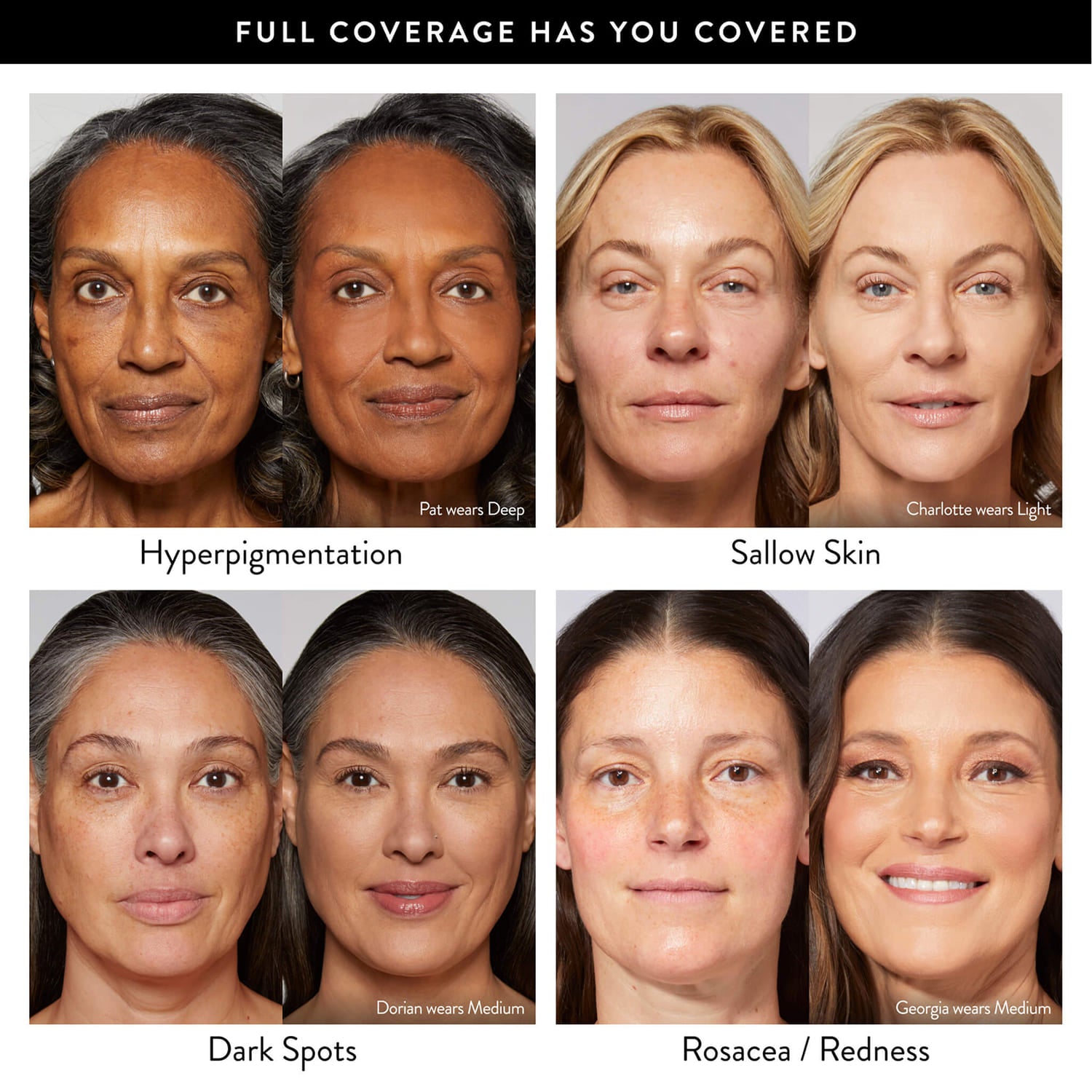 The Baked Starter Kit - Full Coverage (3PC)